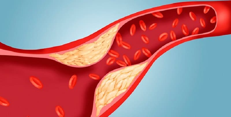 Here are 5 juices that control cholesterol